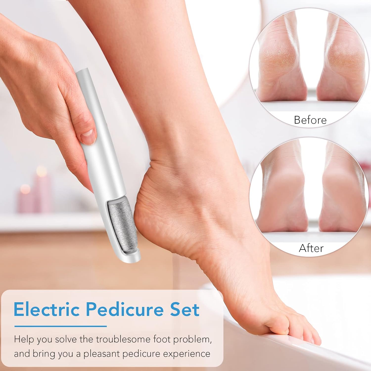 Linkevap Electric Callus Remover For Feet, Professional Pedicure Kit Foot Scrubber For Dry, Dead, Cracked, Hard Skin, At Home Feet Spa Care Kit For Men & Women (Cold White)