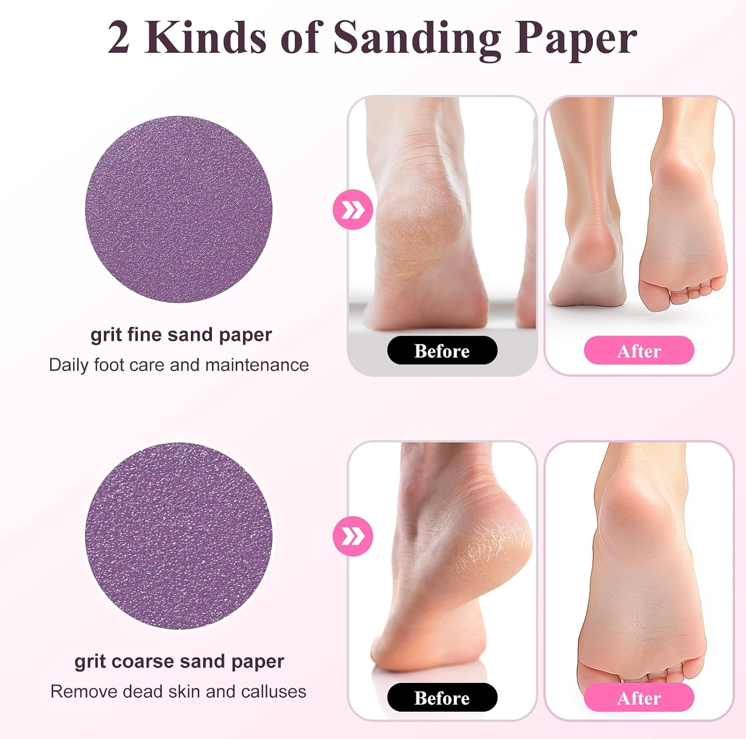 Electric Callus Remover For Feet, Rechargable Foot File | 3 Speeds Foot Callus Remover, Waterproof Pedicure Kit With Foot Cream, Professional Feet Care For Dead, Hard Cracked Dry Skin