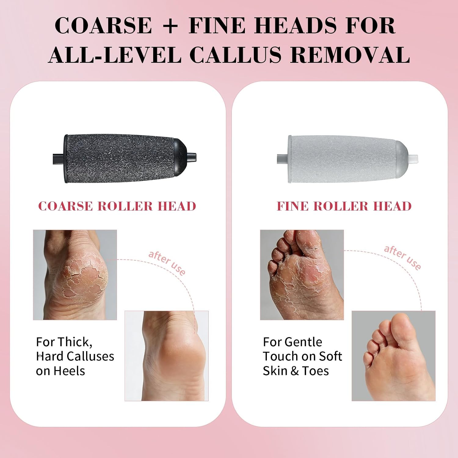 Highlights build quality, grip, and the working end of the callus remover.