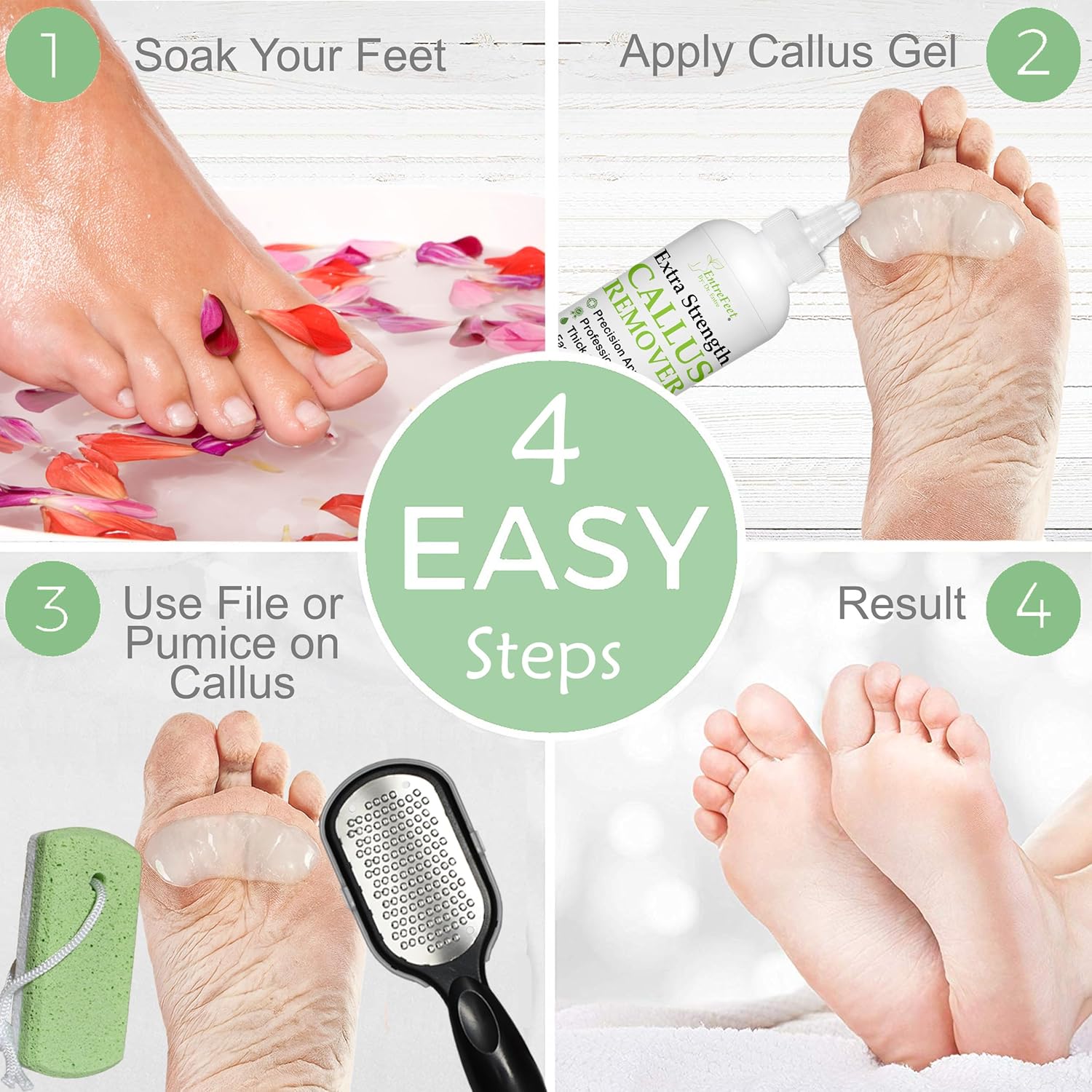 Dr. Entre's Callus Remover Gel Kit For Feet: Foot File, Pumice Stone, 5 Glove Pairs For Gel Application, Spa Kit, Foot Care, Pedicure Tools, Scrubber, 8Oz