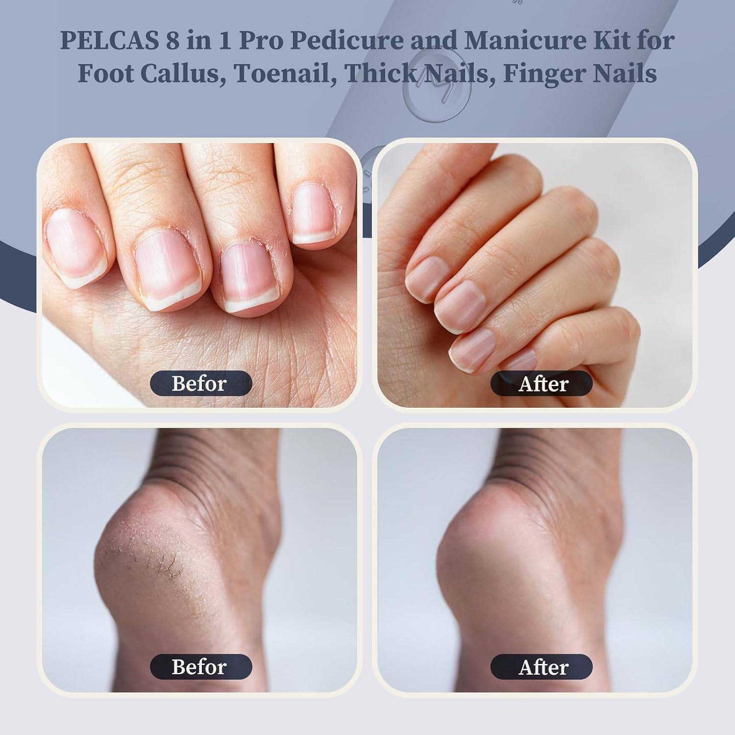Pelcas Electric Nail Filer, Cordless Nail Drill With LED Light & 5 Speeds