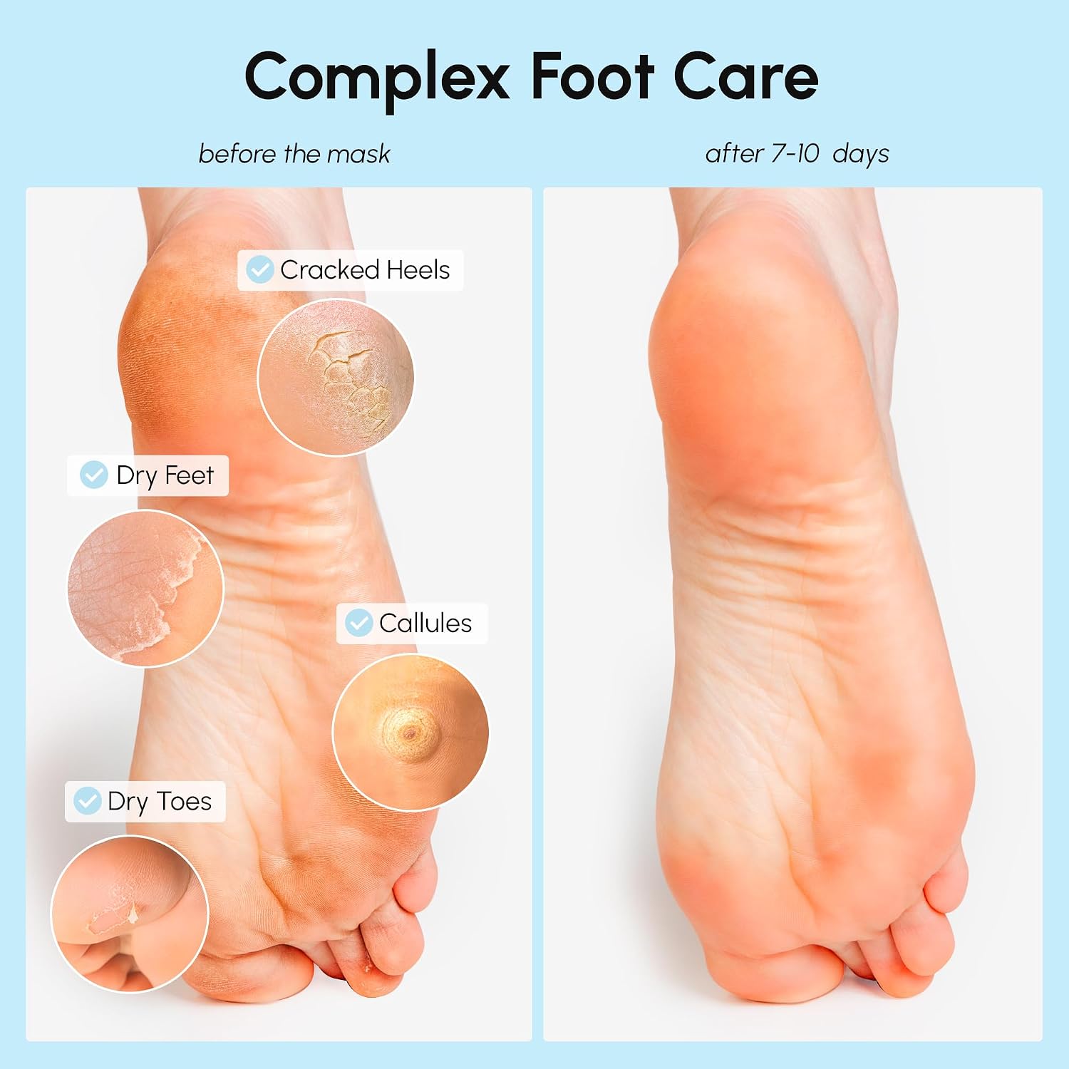 The exfoliating actives and treatment-oriented positioning of the formula.