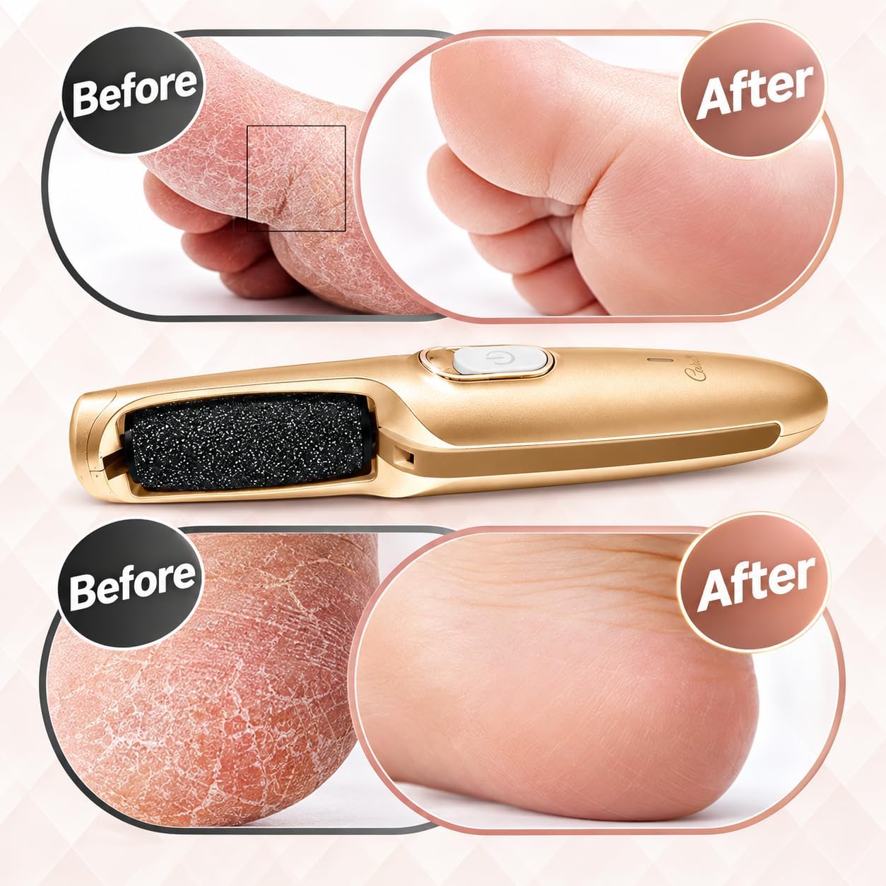 Technical features such as the diamond-coated roller texture, LED light, or speed controls.
